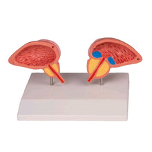 Anatomisches Prostata-Modell, 2-teilig: Querschnittshälften auf Sockel, 3/4
