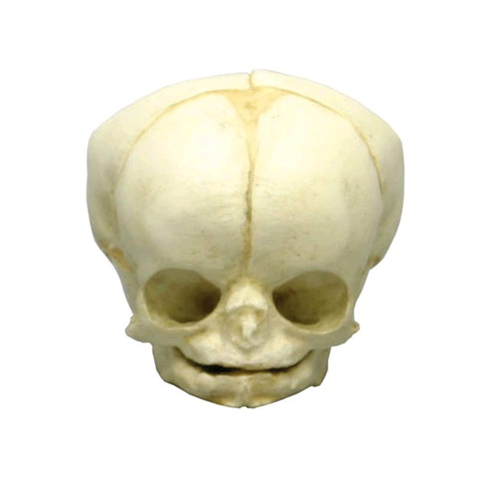 Anatomisches Fetusschädel-Modell von Erler Zimmer, Ansicht von vorn