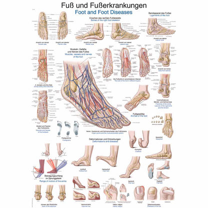 Anatomische Poster-Lehrtafel zu Fuß und Fußerkrankungen mit Detailansichten