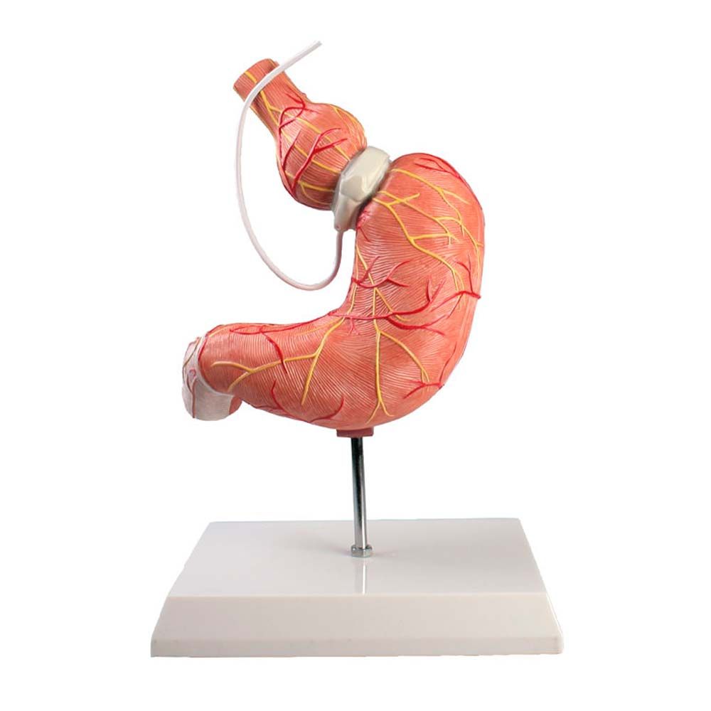 Magenmodell mit Magenband, auf Stativständer, anatomische Darstellung, abnehmbar