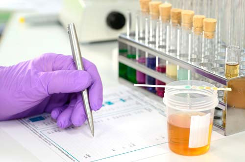 Laboratorium voor drugstests