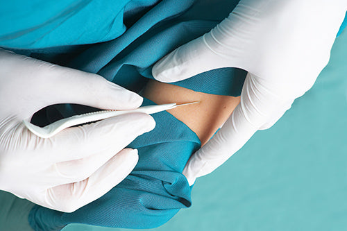 snede met een scalpel